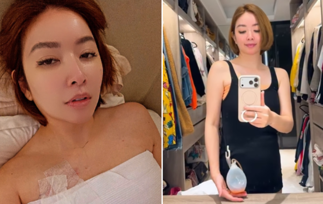 許維恩PO抗乳癌照片！身上掛引流球 ...