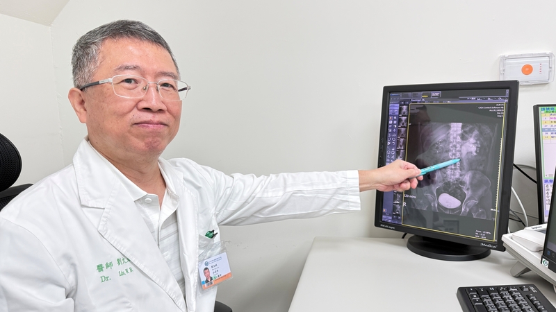 醫師指出男子因輸尿管結石併發腎水腫 (圖)