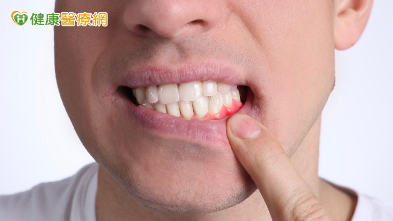 加國病人牙齦萎縮影響進食來台求醫　「...