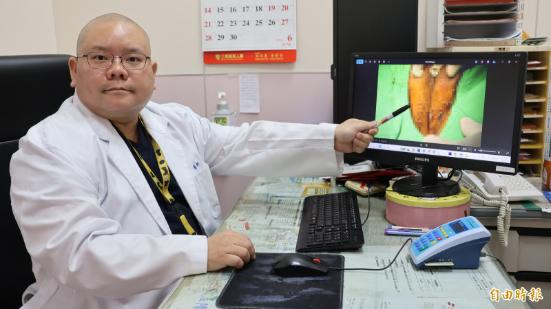 下體癢爆2年！30歲男「手賤捏破」 ...