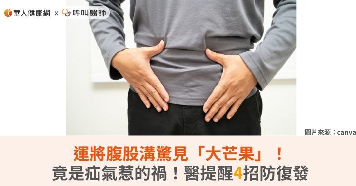 運將腹股溝驚見「大芒果」！竟是疝氣惹...
