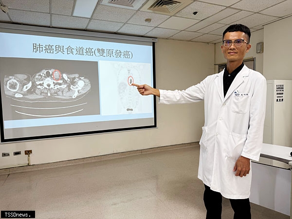 台商肺癌術後8年 竟又罹雙癌