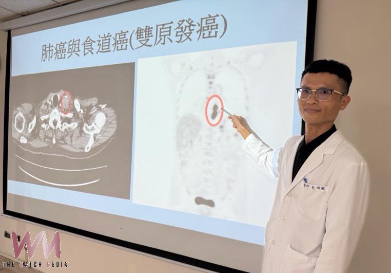 68歲台商驚罹雙癌　醫：肺癌追蹤應同步安排胃鏡篩檢