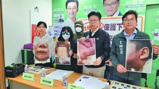 台南 虐嬰致失明失聰 2保母起訴