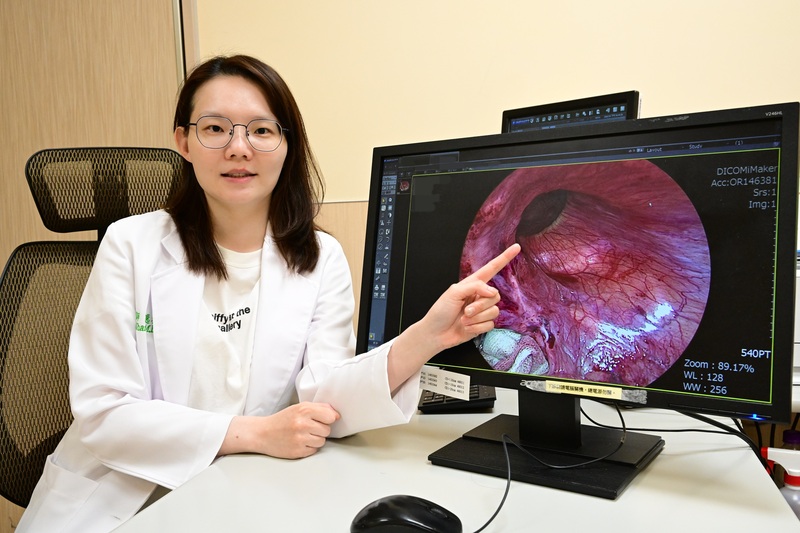 運將右腹腫成芒果大　腸子卡死嵌頓疝氣...