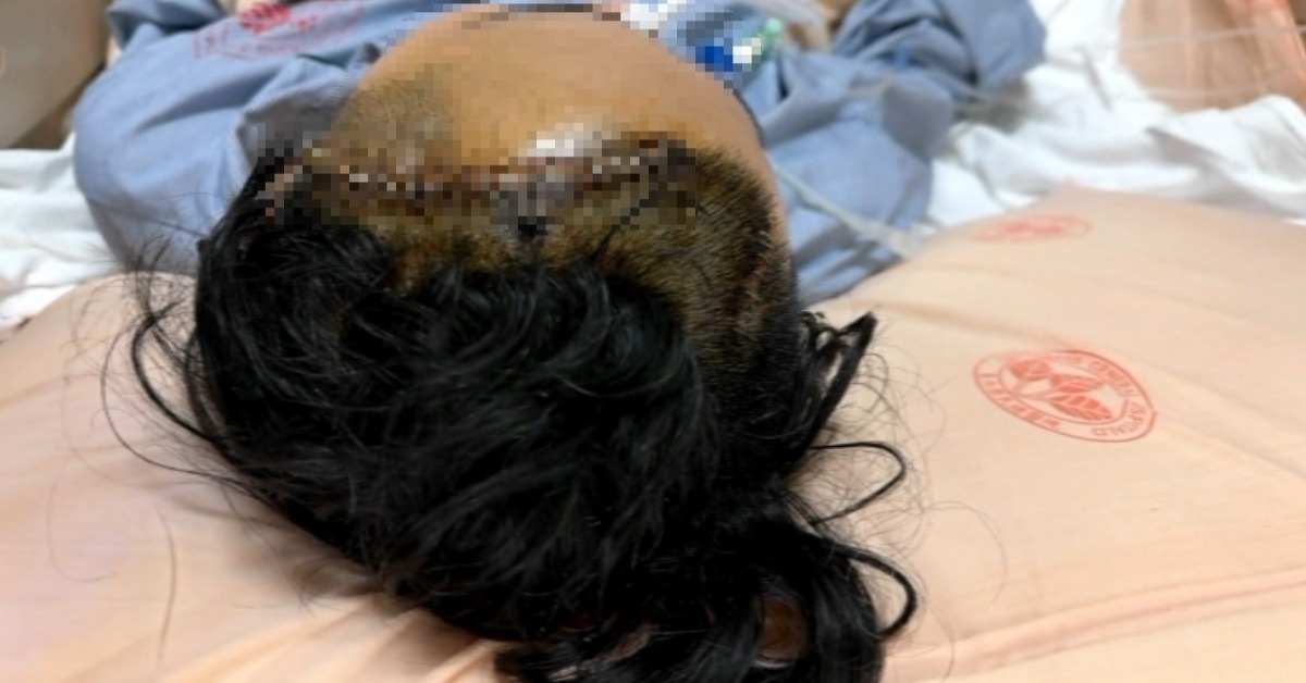 男腦出血被當酒駕「4小時才送醫」 孕妻槓警