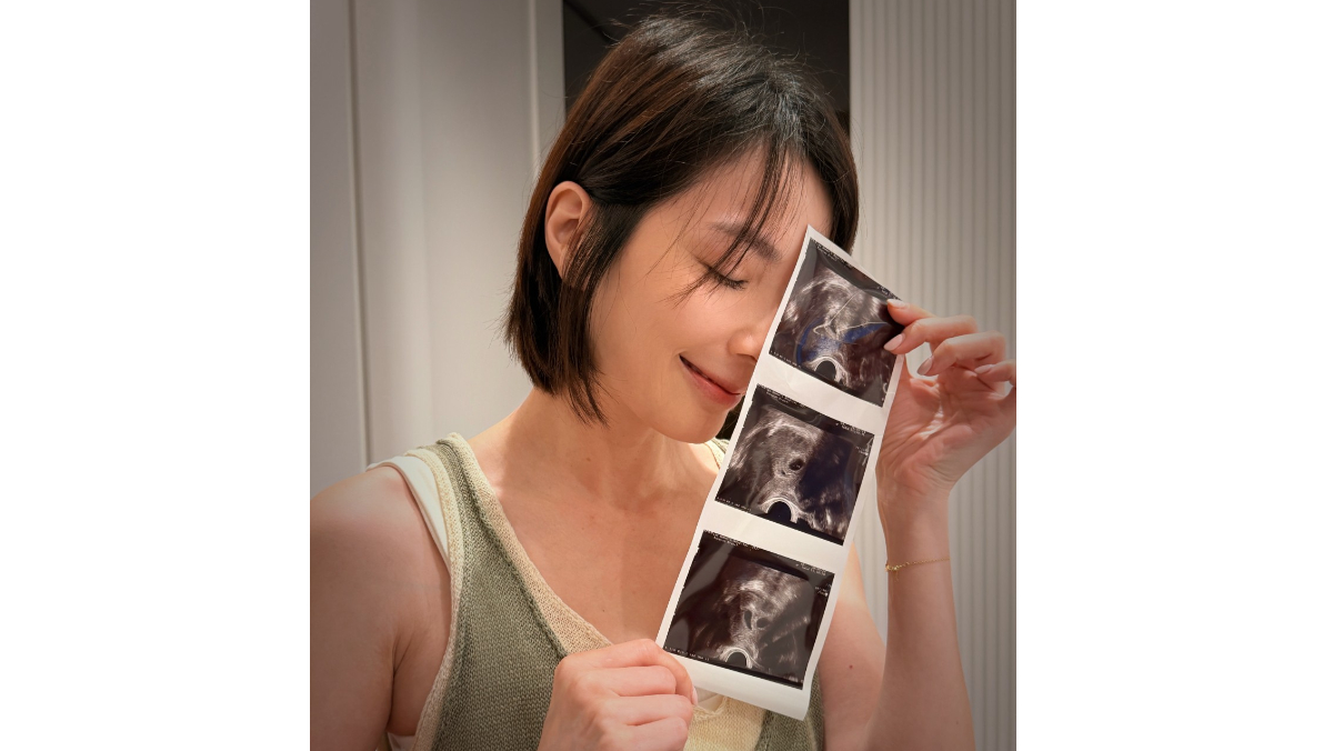 王嫚萱43歲懷雙胞胎　「最好的生日禮物」