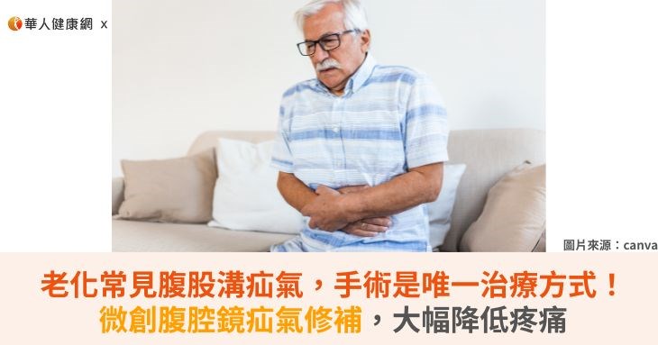 老化常見腹股溝疝氣，手術是唯一治療方...